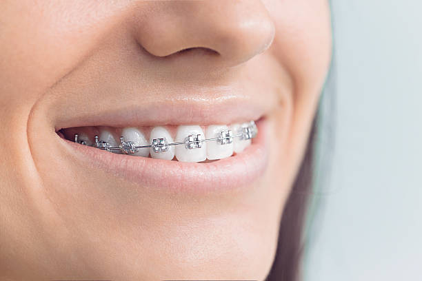 Best Veneers and Lumineers  in Bellevue, ID